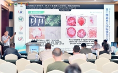 医院烧伤整形科新技术在第十四届亚太国际烧伤会议上进行交流